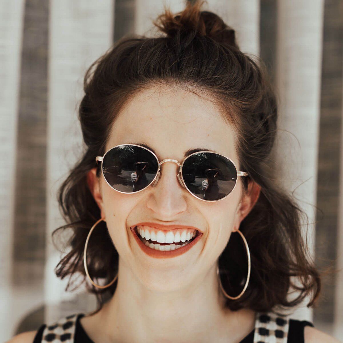 Teeth whitening or veneers