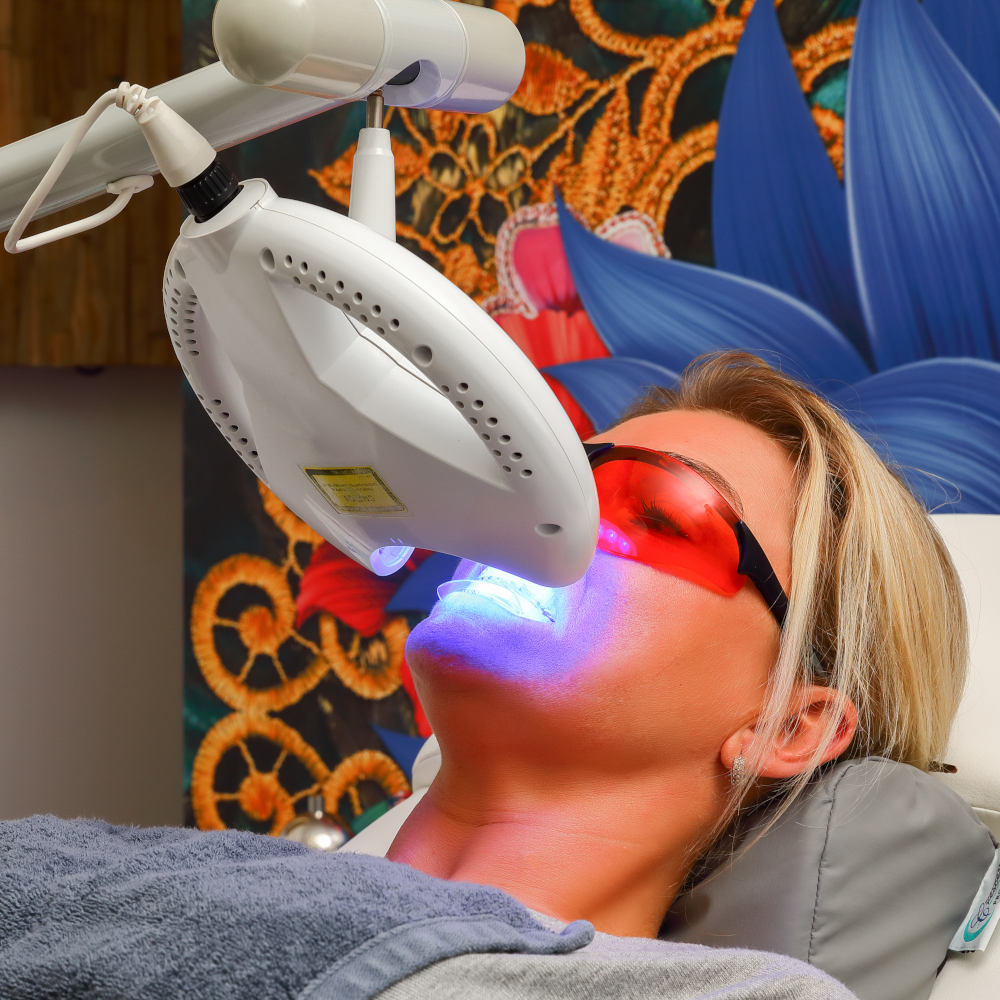 Bleaching oder Zahnaufhellung