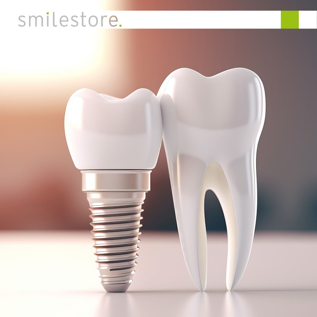 Why implants and bridges require particularly careful maintenance