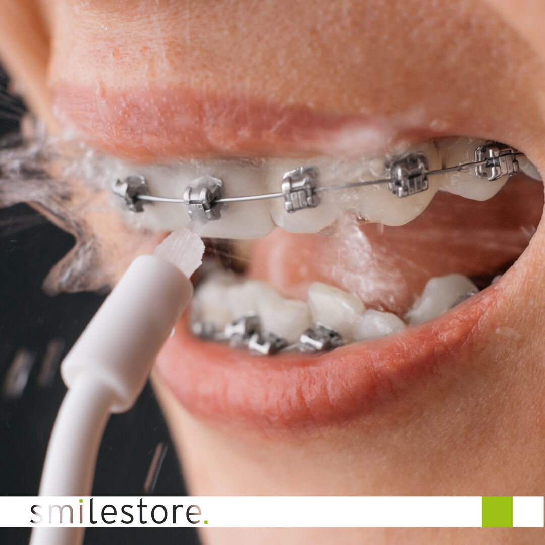 Oral irrigators – useful or unnecessary?